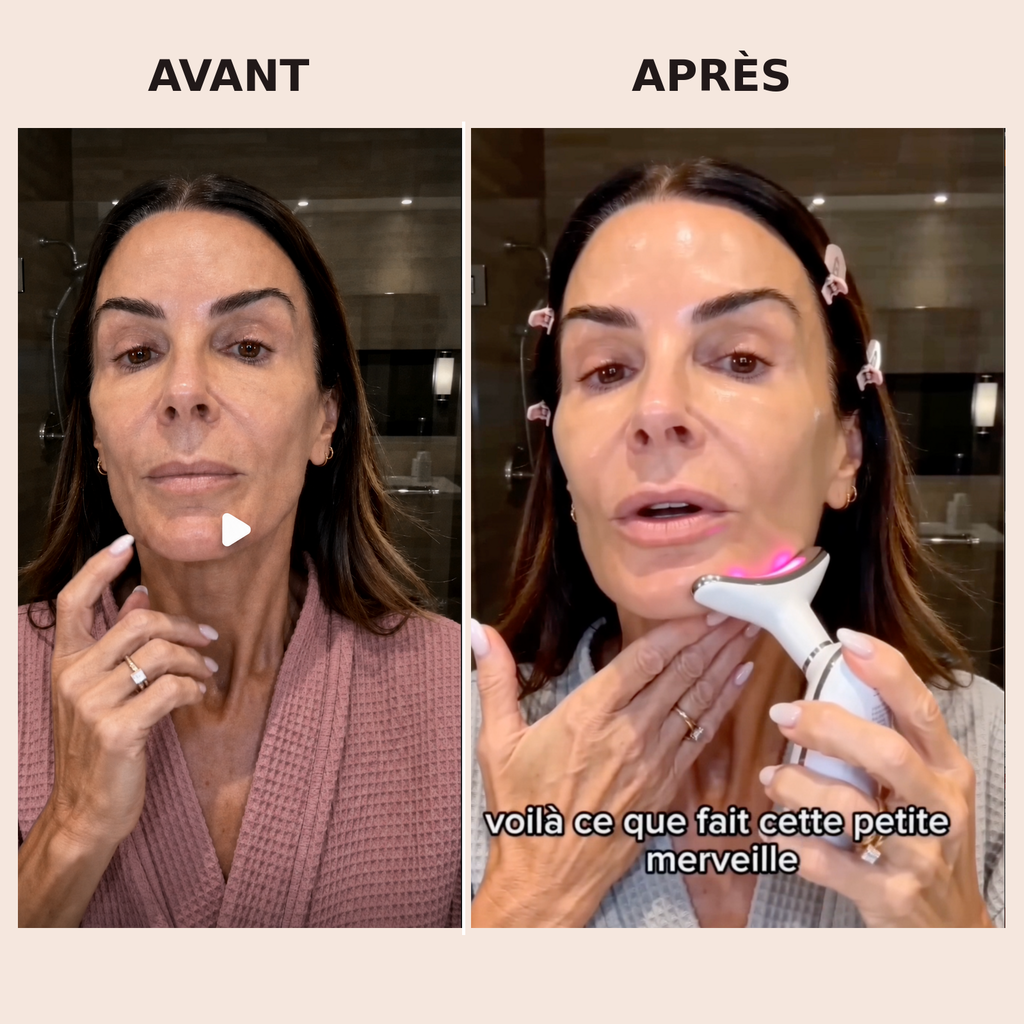 Appareil Liftant, Lissant & Raffermissant, Visage et Cou
